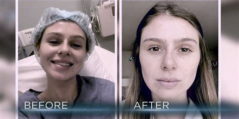 Vanderpump Rules Photos Raquel Before After Nose Job