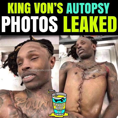King Vons Autopsy