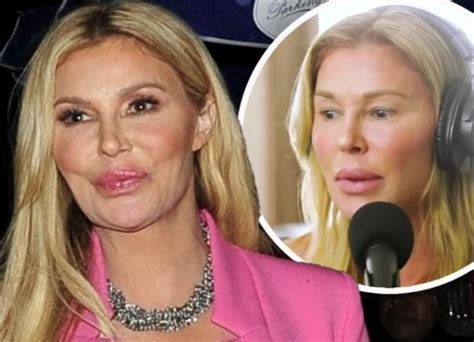 Rhobh Brandi Glanville Plastic Surgery Transformation In Photos