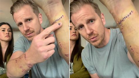 The Bachelor Season 17 Sean Lowe Forever Traumatized After Attacked Family Dog What Happen Pooch Explainer