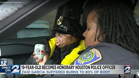 Zaid Garcia Story Inspiring Teen Who Suffered Severe Burns Becomes Honorary Police
