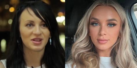 90 Day Fiance Yara Face Changed Plastic Surgery
