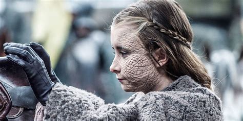 Game Thrones Greyscale Cure How Explained