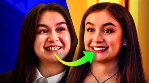 Anna Cathcart Teeth Xo Kitty Season 2 New Look Dentists Explained