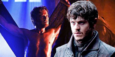 Why Theon Greyjoy Was Tortured In Game Of Thrones